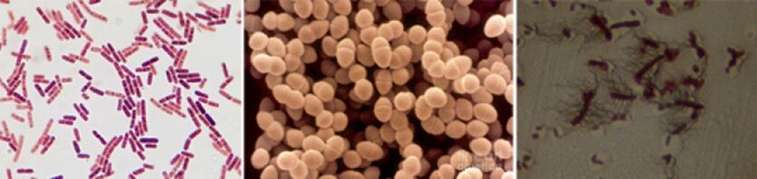 E. coli, fecal enterococcus a proteus sinn d'Haaptverursaacher vun chronescher bakterieller Prostatitis